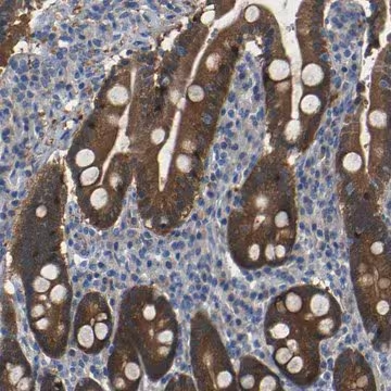 Anti-TBC1D32 antibody produced in rabbit, 1 X 100 µL (HPA013413-100UL)
