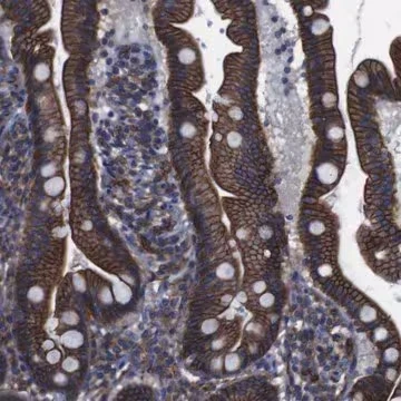 Anti-SPTBN1 antibody produced in rabbit, 1 X 100 µL (HPA013149-100UL)