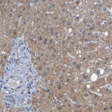 Anti-DHODH antibody produced in rabbit, 1 X 100 µL (HPA011942-100UL)