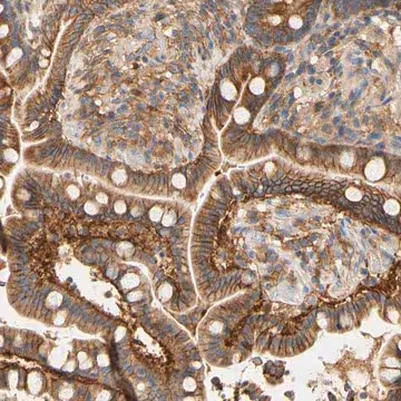 Anti-PCDH7 antibody produced in rabbit, 1 X 100 µL (HPA011866-100UL)