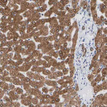 Anti-ERLIN1 antibody produced in rabbit, 1 X 100 µL (HPA011252-100UL)