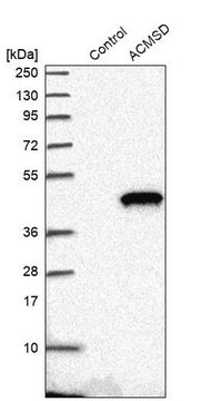 Anti-ACMSD antibody produced in rabbit, 1 X 100 µL (HPA011179-100UL)