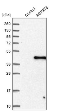 Anti-AGPAT5 antibody produced in rabbit, 1 X 100 µL (HPA010950-100UL)