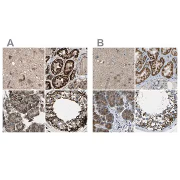 Anti-CYB5R1 antibody produced in rabbit, 1 X 100 µL (HPA010641-100UL)