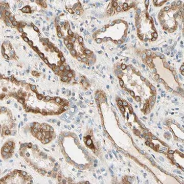 Anti-LAMA3 antibody produced in rabbit, 1 X 100 µL (HPA009309-100UL)