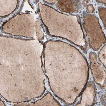 Anti-TTC14 antibody produced in rabbit, 1 X 100 µL (HPA009295-100UL)