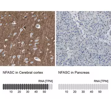Anti-NFASC antibody produced in rabbit, 1 X 100 µL (HPA008832-100UL)
