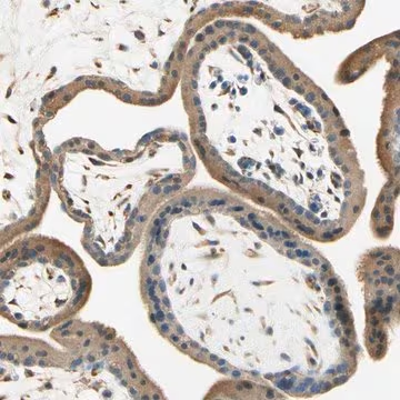 Anti-IGDCC4 antibody produced in rabbit, 1 X 100 µL (HPA008576-100UL)