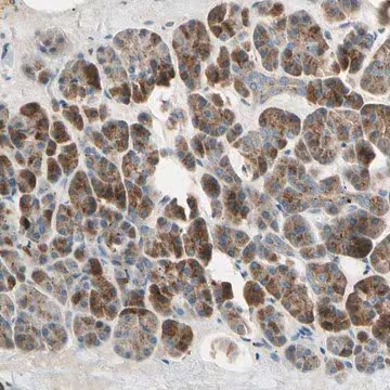 Anti-AKAP9 antibody produced in rabbit, 1 X 100 µL (HPA008548-100UL)