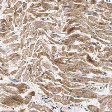 Anti-PDK2 antibody produced in rabbit, 1 X 100 µL (HPA008287-100UL)