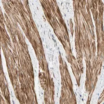 Anti-P4HA3 antibody produced in rabbit, 1 X 100 µL (HPA007897-100UL)