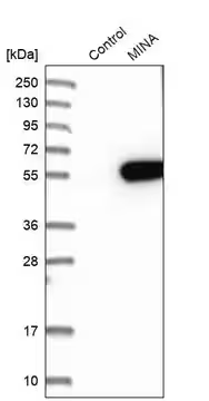 Anti-RIOX2 antibody produced in rabbit, 1 X 100 µL (HPA007603-100UL)