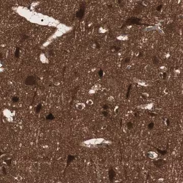 Anti-PRKG2 antibody produced in rabbit, 1 X 100 µL (HPA007386-100UL)