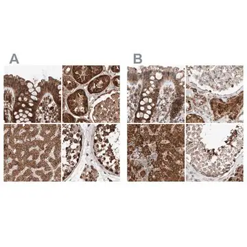Anti-ZSCAN29 antibody produced in rabbit, 1 X 100 µL (HPA007241-100UL)