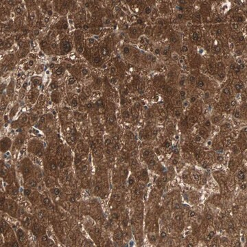 Anti-ZSCAN31 antibody produced in rabbit, 1 X 100 µL (HPA007124-100UL)
