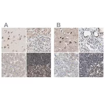 Anti-ZHX2 antibody produced in rabbit, 1 X 100 µL (HPA006996-100UL)