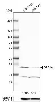 Anti-SAR1A antibody produced in rabbit, 1 X 100 µL (HPA006923-100UL)
