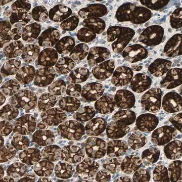 Anti-CMC2 antibody produced in rabbit, 1 X 100 µL (HPA006871-100UL)