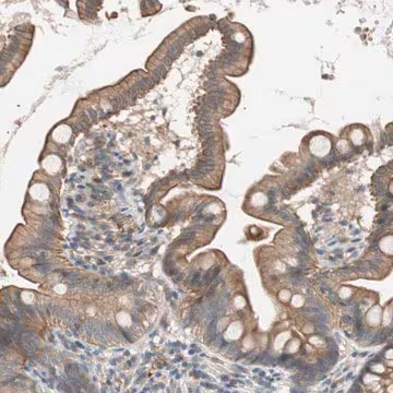 Anti-SMG1 antibody produced in rabbit, 1 X 100 µL (HPA006870-100UL)