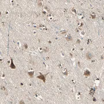 Anti-NIT1 antibody produced in rabbit, 1 X 100 µL (HPA006657-100UL)