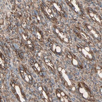 Anti-EPB41L2 antibody produced in rabbit, 1 X 100 µL (HPA006642-100UL)