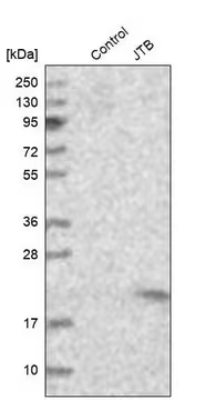 Anti-JTB antibody produced in rabbit, 1 X 100 µL (HPA006514-100UL)