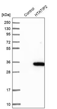 Anti-HTATIP2 antibody produced in rabbit, 1 X 100 µL (HPA006417-100UL)