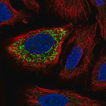 Anti-ZNF230 antibody produced in rabbit, 100 µL (HPA006172-100UL)