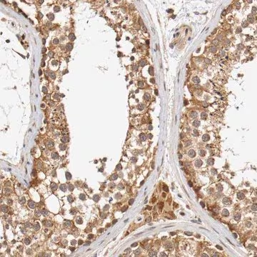Anti-VEZT antibody produced in rabbit, 1 X 100 µL (HPA004811-100UL)