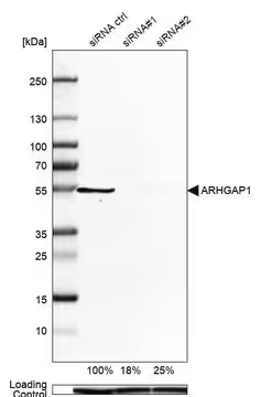 Anti-ARHGAP1 antibody produced in rabbit, 1 X 100 µL (HPA004689-100UL)