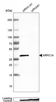 Anti-ARPC1A antibody produced in rabbit, 1 X 100 µL (HPA004334-100UL)