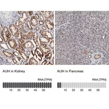 Anti-AUH antibody produced in rabbit, 1 X 100 µL (HPA004171-100UL)