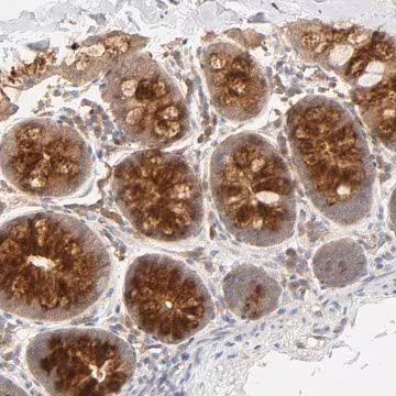 Anti-AP1G2 antibody produced in rabbit, 1 X 100 µL (HPA004106-100UL)