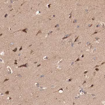 Anti-PITPNM2 antibody produced in rabbit, 1 X 100 µL (HPA003978-100UL)