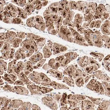 Anti-NDUFB8 antibody produced in rabbit, 1 X 100 µL (HPA003886-100UL)