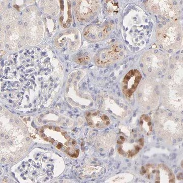 Anti-F13B antibody produced in rabbit, 1 X 100 µL (HPA003827-100UL)
