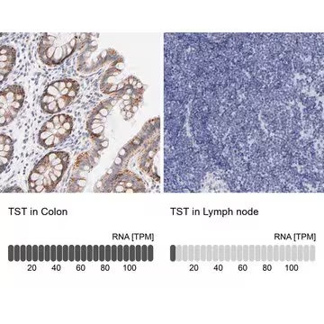 Anti-TST antibody produced in rabbit, 1 X 100 µL (HPA003643-100UL)