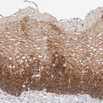 Anti-VIPAS39 antibody produced in rabbit, 1 X 100 µL (HPA003593-100UL)