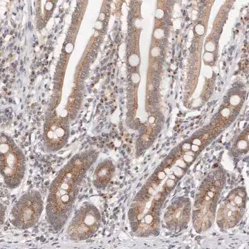 Anti-VIPAS39 antibody produced in rabbit, 1 X 100 µL (HPA003589-100UL)