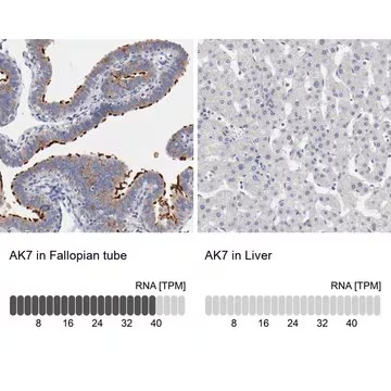 Anti-AK7 antibody produced in rabbit, 1 X 100 µL (HPA003543-100UL)