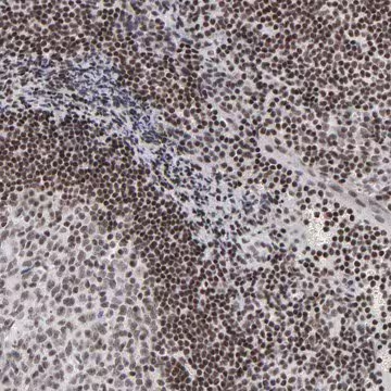 Anti-SP2 antibody produced in rabbit, 1 X 100 µL (HPA003357-100UL)