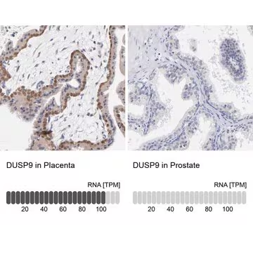 Anti-DUSP9 antibody produced in rabbit, 1 X 100 µL (HPA003336-100UL)