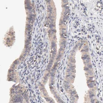 Anti-ZNF157 antibody produced in rabbit, 1 X 100 µL (HPA003319-100UL)