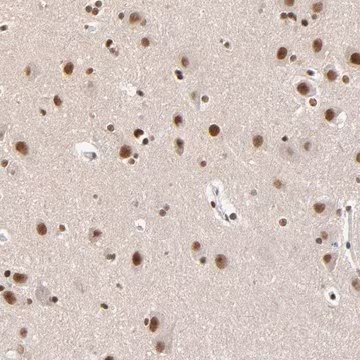 Anti-ZMYM3 antibody produced in rabbit, 1 X 100 µL (HPA003211-100UL)