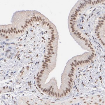 Anti-ELMSAN1 antibody produced in rabbit, 1 X 100 µL (HPA003111-100UL)