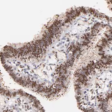 Anti-ZFP92 antibody produced in rabbit, 1 X 100 µL (HPA003030-100UL)