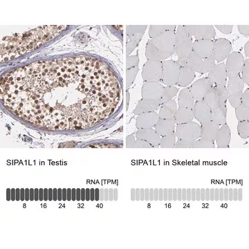 Anti-SIPA1L1 antibody produced in rabbit, 1 X 100 µL (HPA002875-100UL)