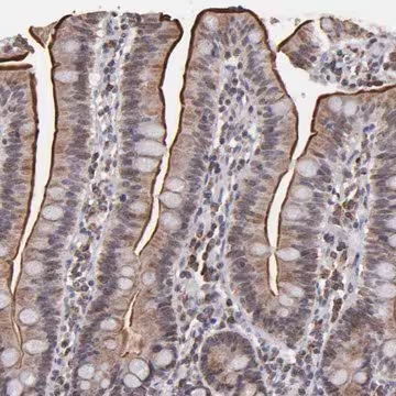Anti-SLC15A1 antibody produced in rabbit, 1 X 100 µL (HPA002827-100UL)
