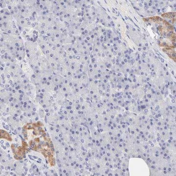 ANTI-TWNK antibody produced in rabbit, 1 X 100 µL (HPA002532-100UL)