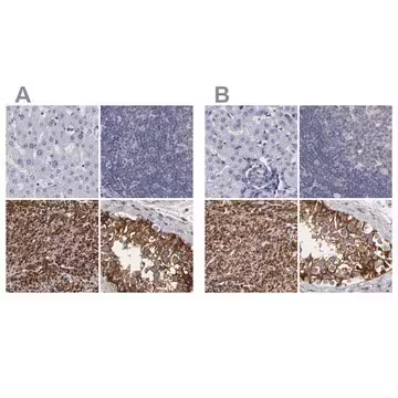 Anti-SLMAP antibody produced in rabbit, 1 X 100 µL (HPA002358-100UL)